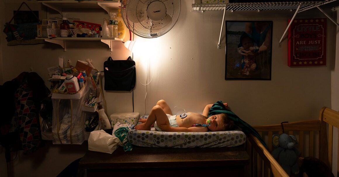 young boy lays on a changing table