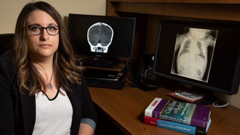 Amanda Brownell sits at her desk with a child's xray appearing on both computer monitors and a pair of child abuse books stacked upon each other on her desk.