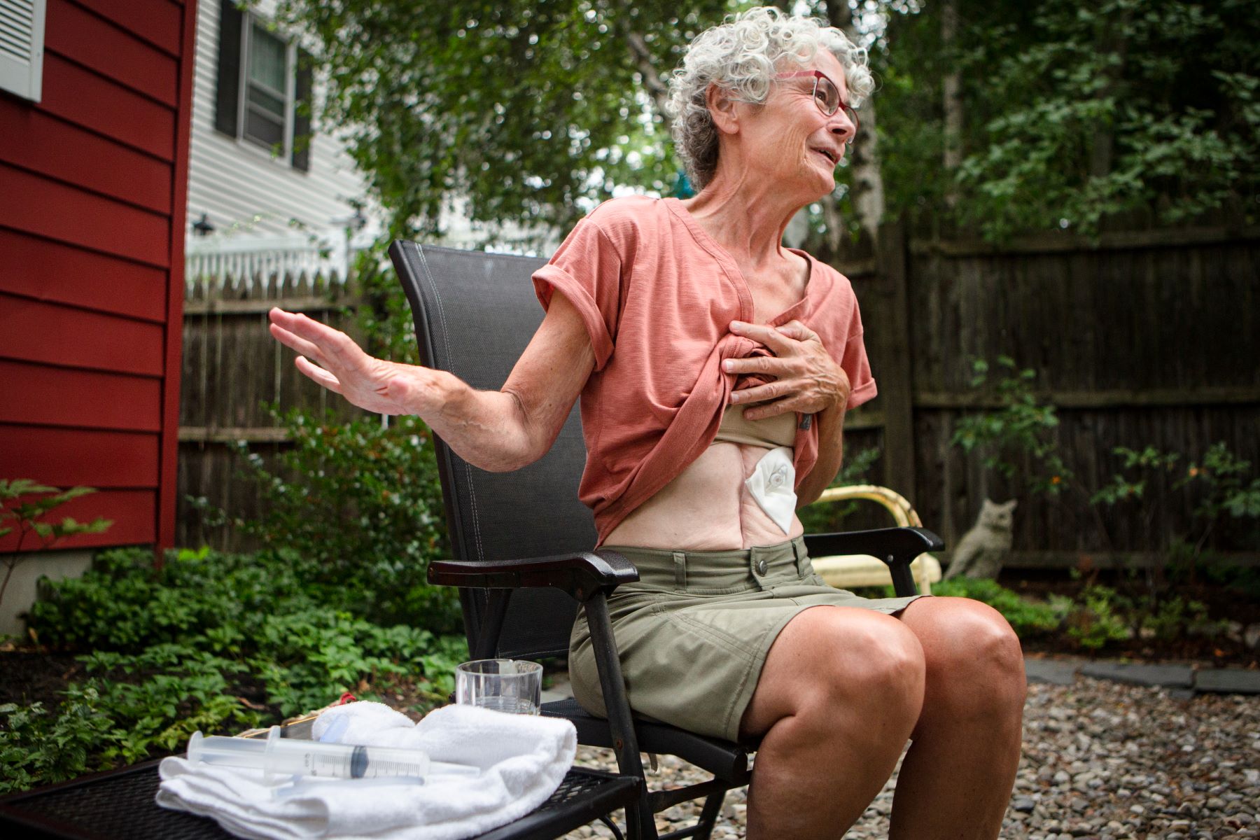 While sitting in a chair in her backyard, Karen Worth lifts up her shirt to show a deep belly scar and feeding port.