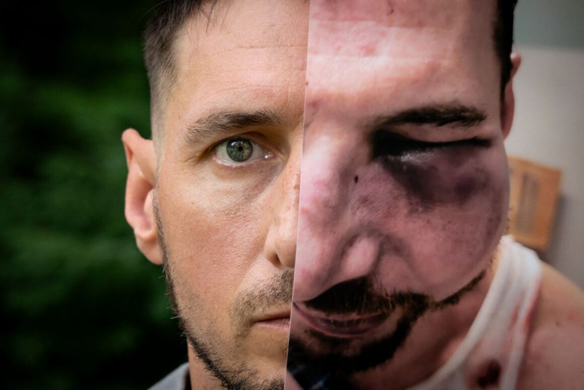A composite image that shows two versions of Justin Savage's face: the modern day version and a version after he was repeatedly punched by law enforcement.