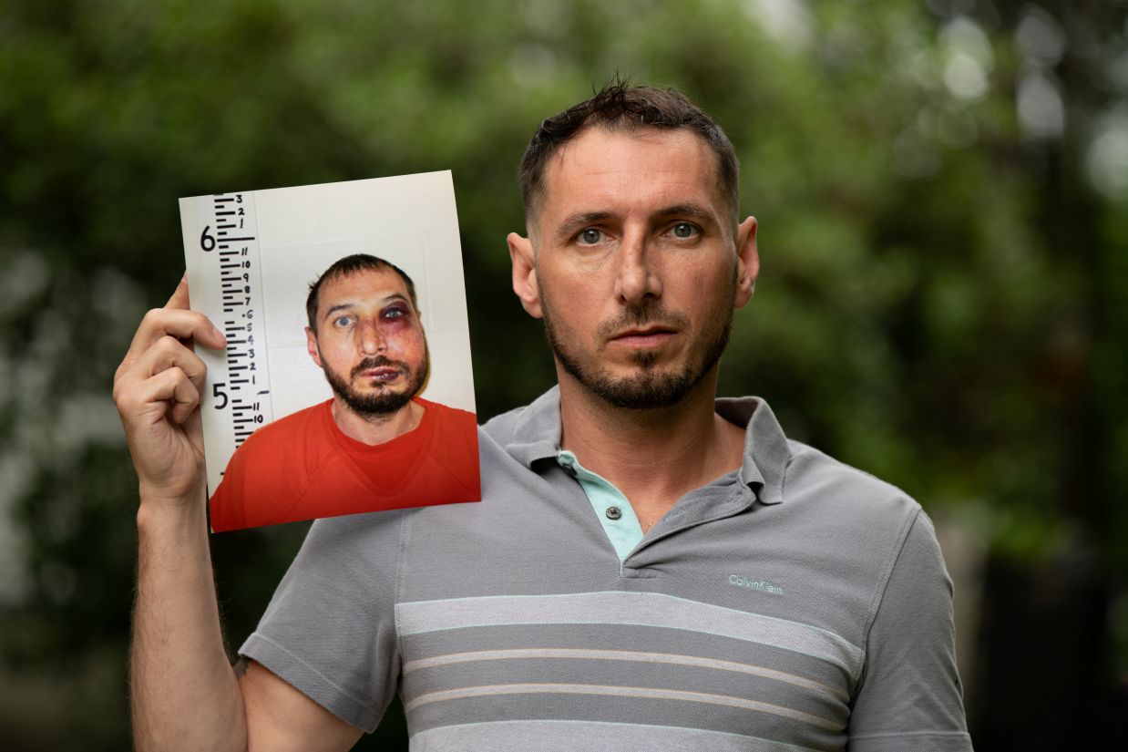 Justin Savage holds up a photo of his mugshot, showing his beaten face.