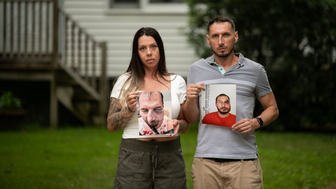 Shawna Morse and Justin Savage pose for a photo while holding images of Justin's bruised face.