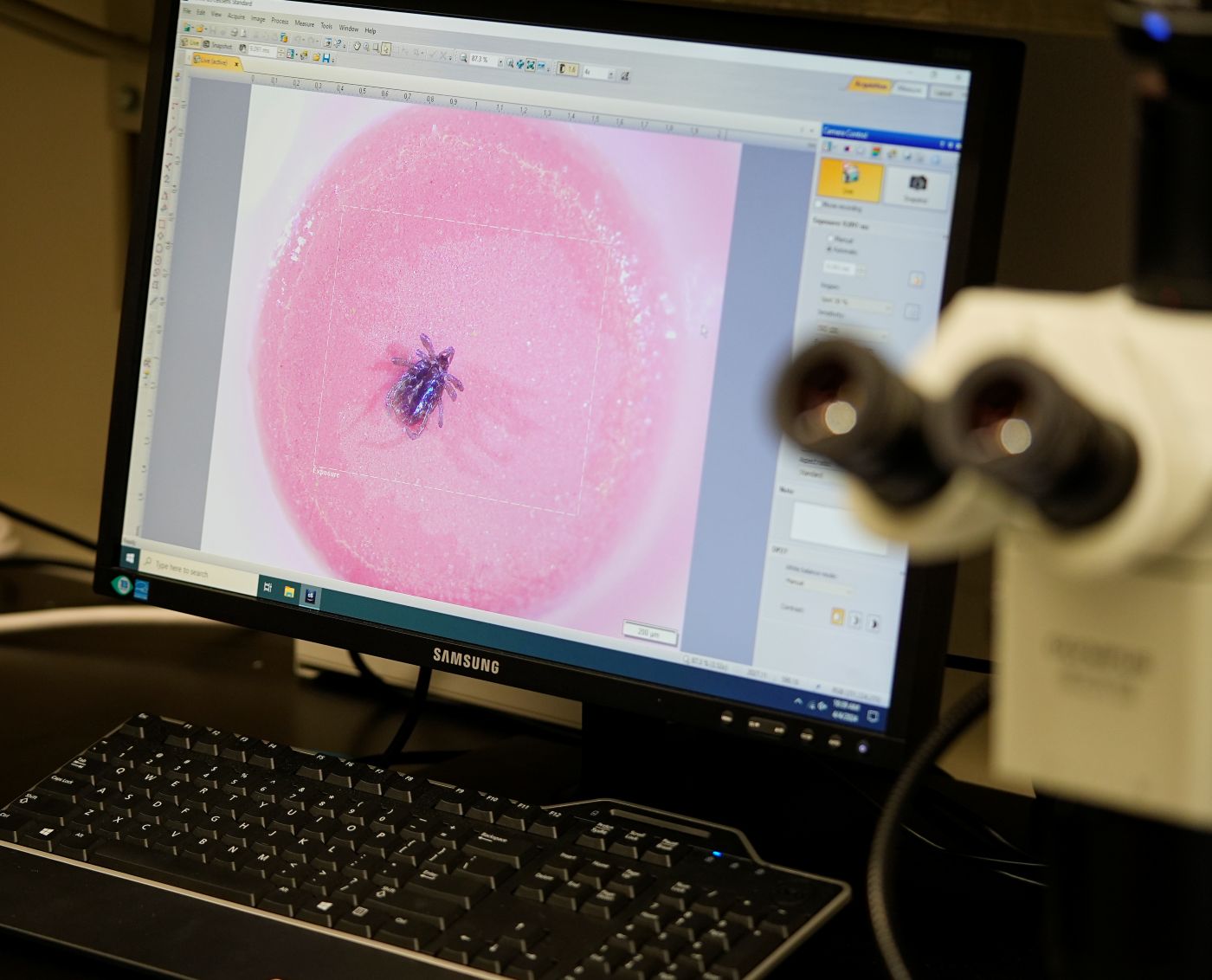 tick magnified on a computer screen.